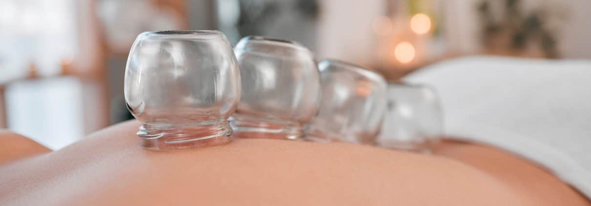 Cupping, therapy and wellness for body in spa, health and healing with alternative medicine. Body care, stress relief and balance, holistic and massage therapy, vacuum banks and healthy treatment.